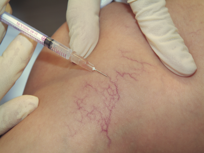 kreussler_13 kreussler_13